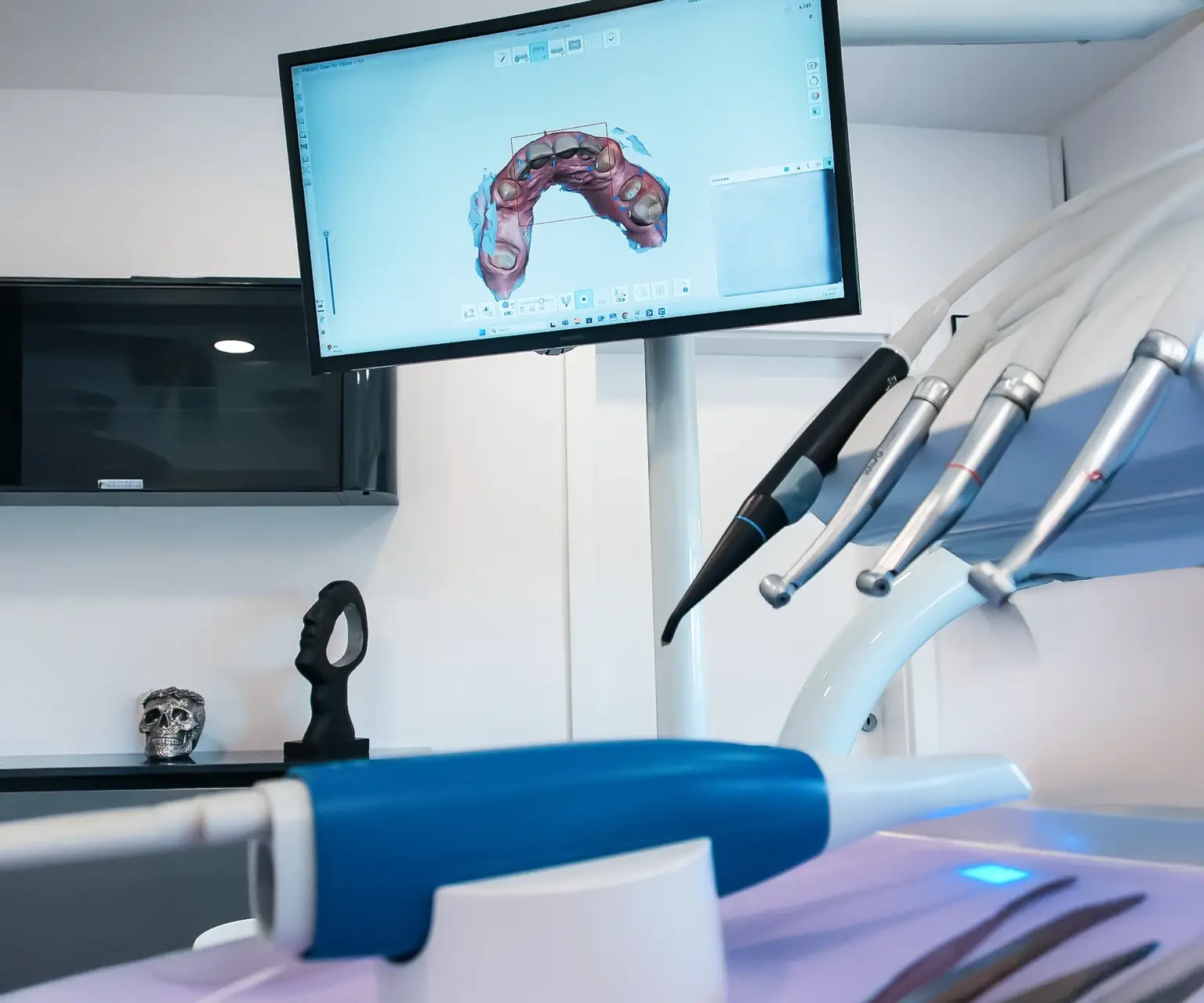 3d snimka oralnog skenera