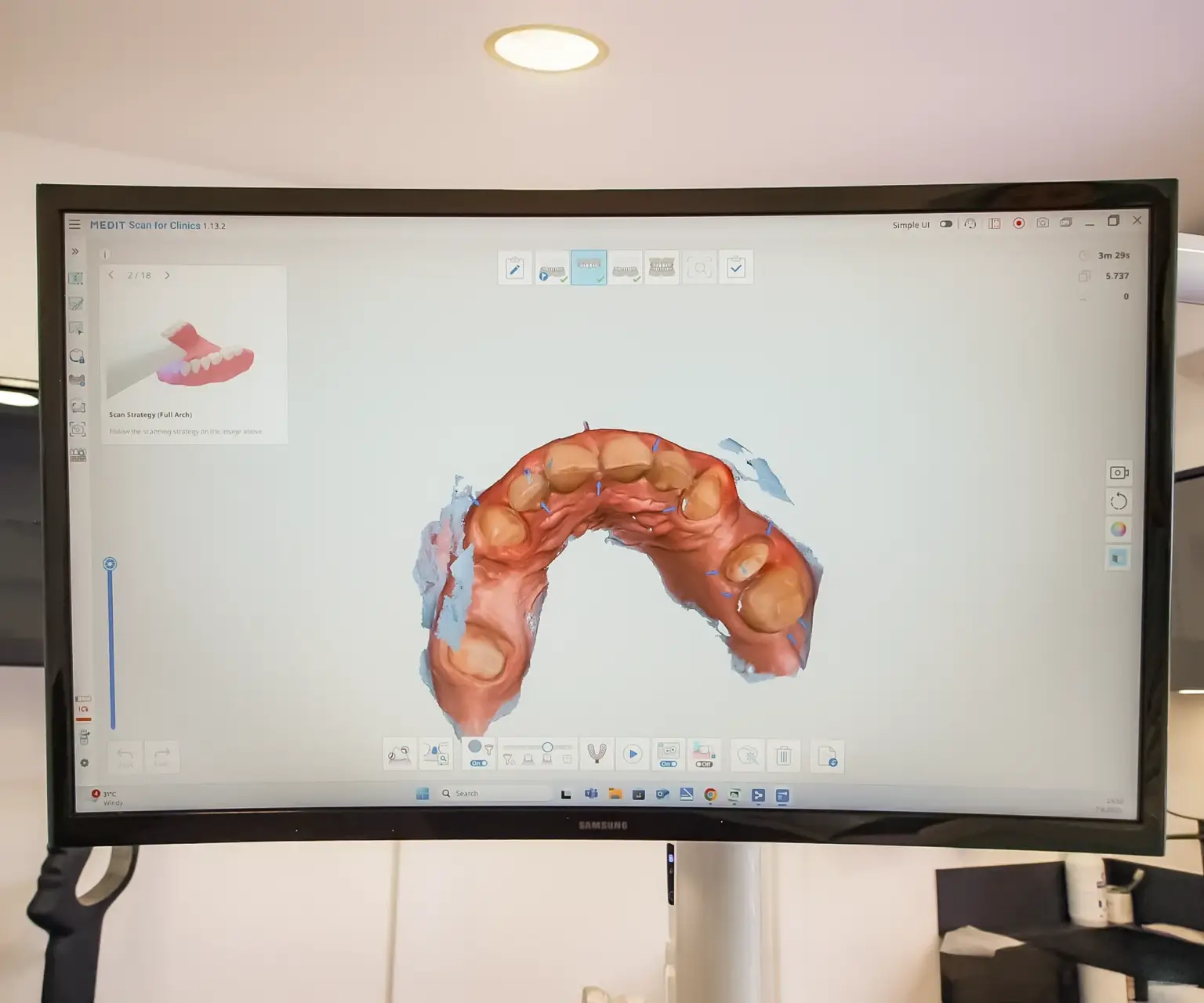 3d snimka oralnog skenera