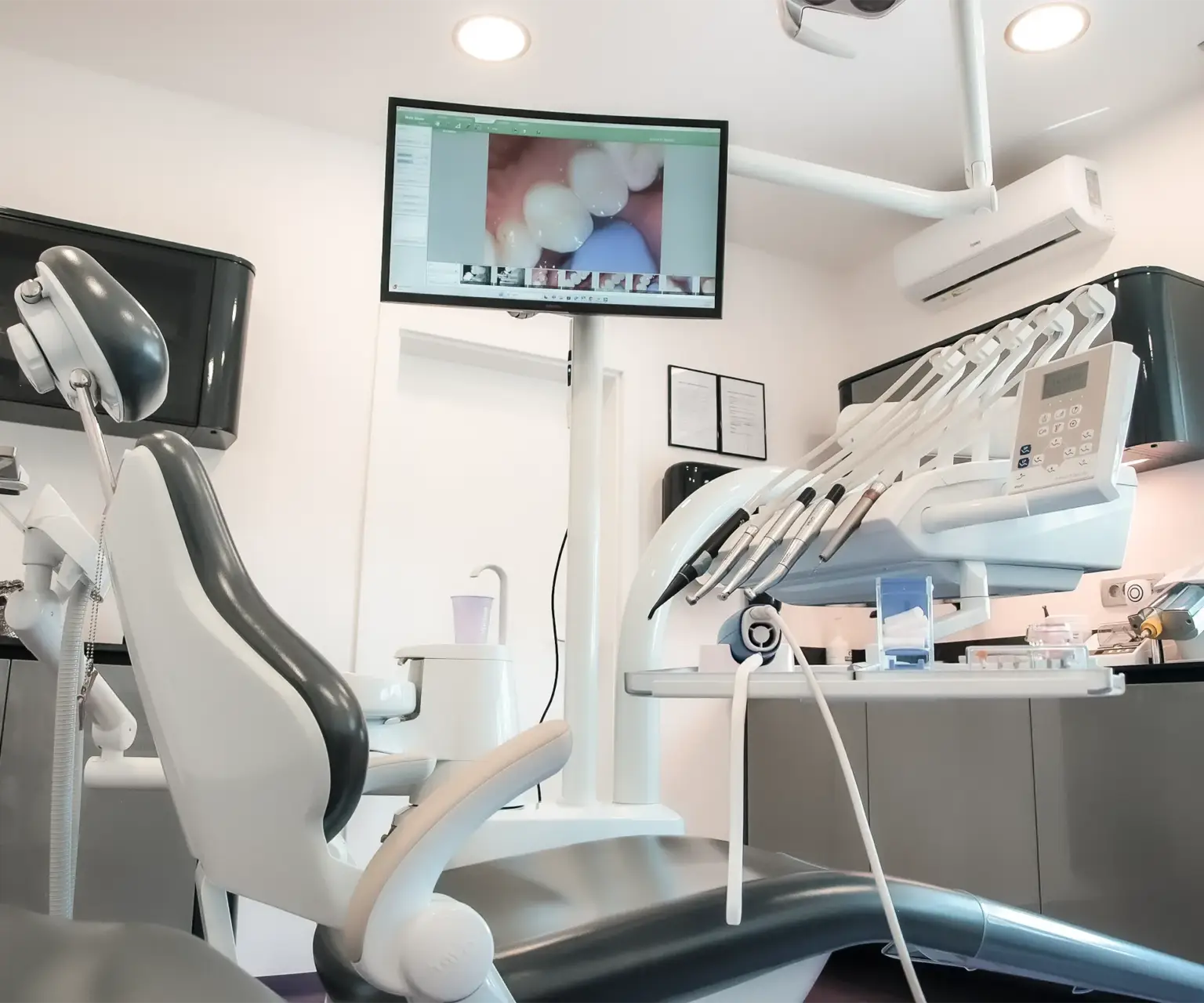 Snimka orelne kamere